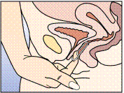 4f8cd11591dd2ec378b8fc4dc5bcd448.gif
