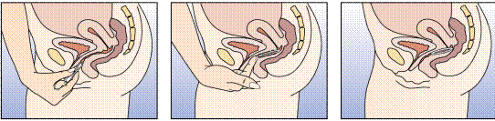 89b39b60c0fcb738c8da48da80993ab1.gif